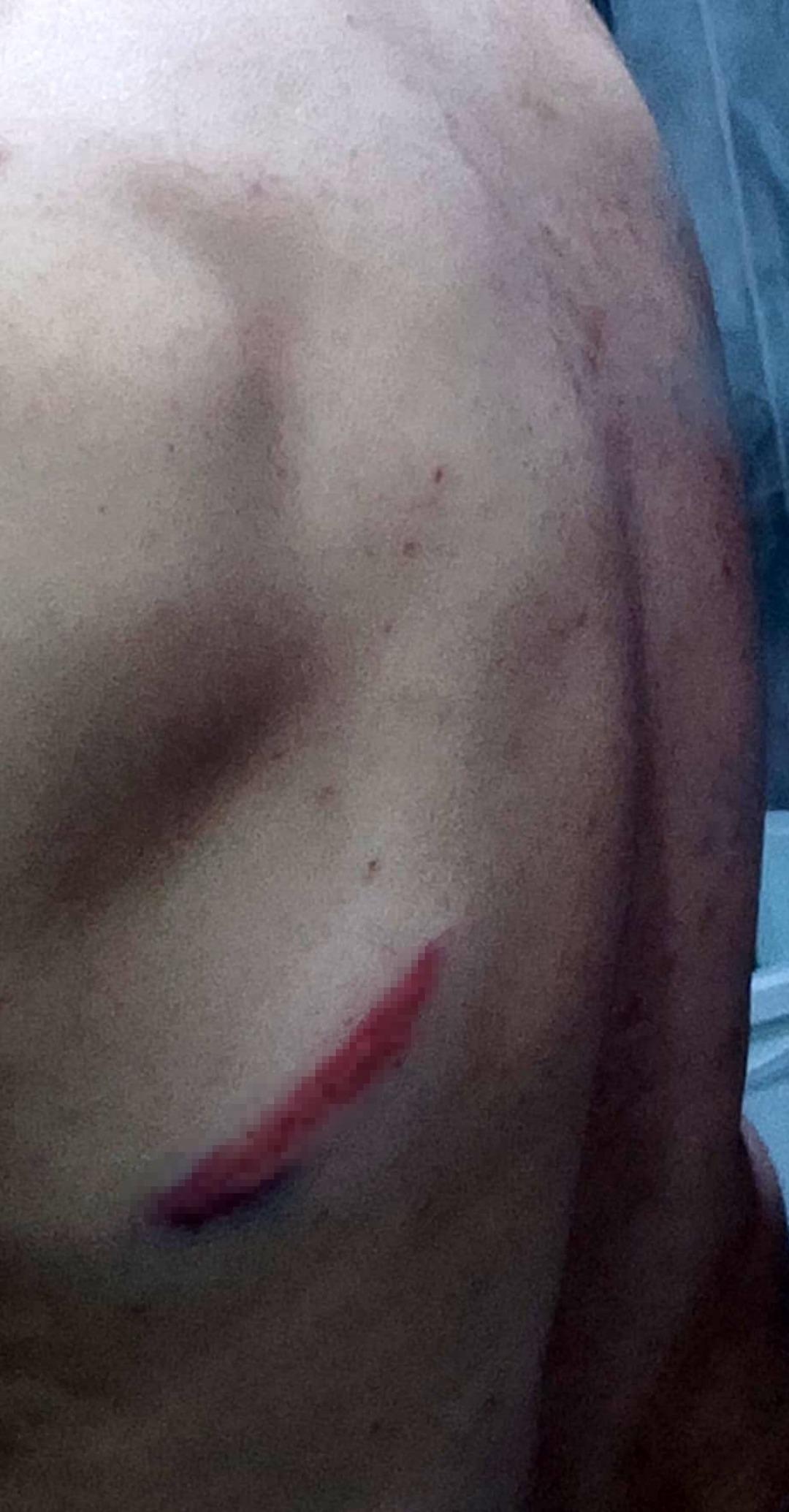 &ldquo;Yaptığınız ayıptır&rdquo; dedi, dayak yedi! Tuvaletini evin &ouml;n&uuml;nde yaptı, ortalık karıştı! 2