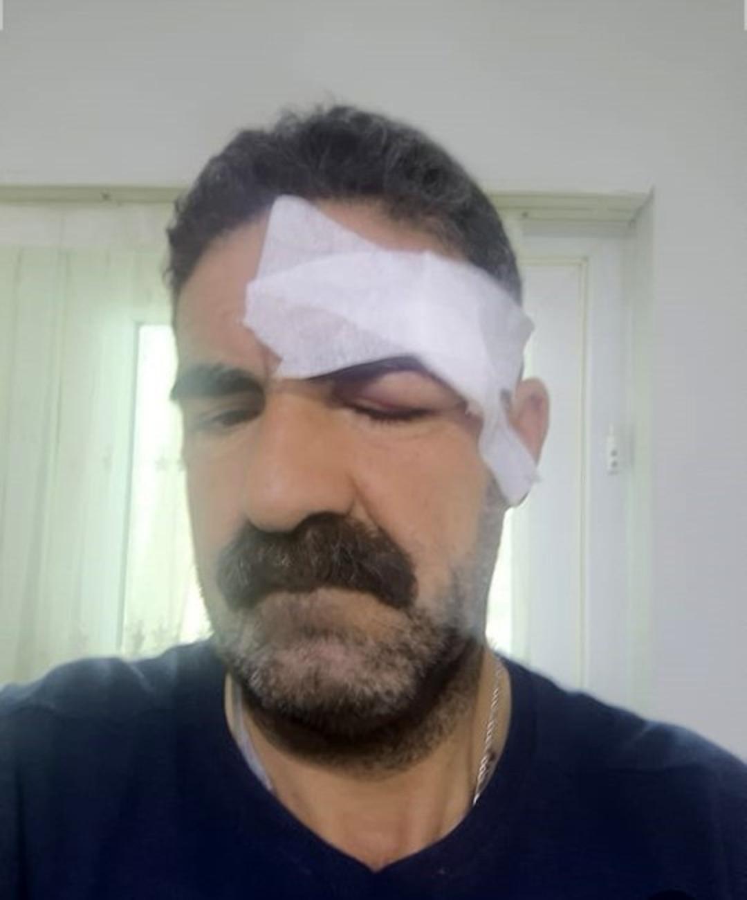 &ldquo;Yaptığınız ayıptır&rdquo; dedi, dayak yedi! Tuvaletini evin &ouml;n&uuml;nde yaptı, ortalık karıştı! 4