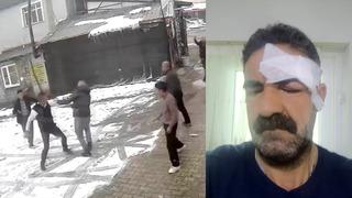 Son dakika: &ldquo;Yaptığınız ayıptır&rdquo; dedi, dayak yedi! Tuvaletini evin &ouml;n&uuml;nde yaptı, ortalık karıştı!