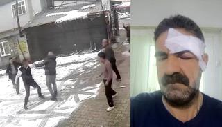 &ldquo;Yaptığınız ayıptır&rdquo; dedi, dayak yedi!