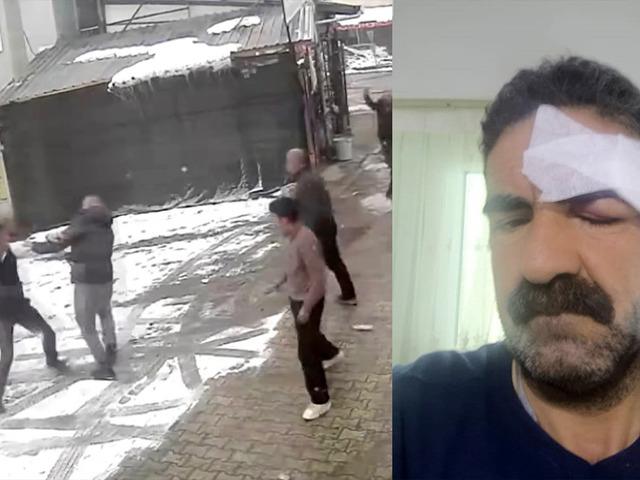 &ldquo;Yaptığınız ayıptır&rdquo; dedi, dayak yedi!