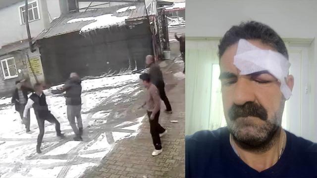 “Yaptığınız ayıptır” dedi, dayak yedi! Tuvaletini evin önünde yaptı, ortalık karıştı!