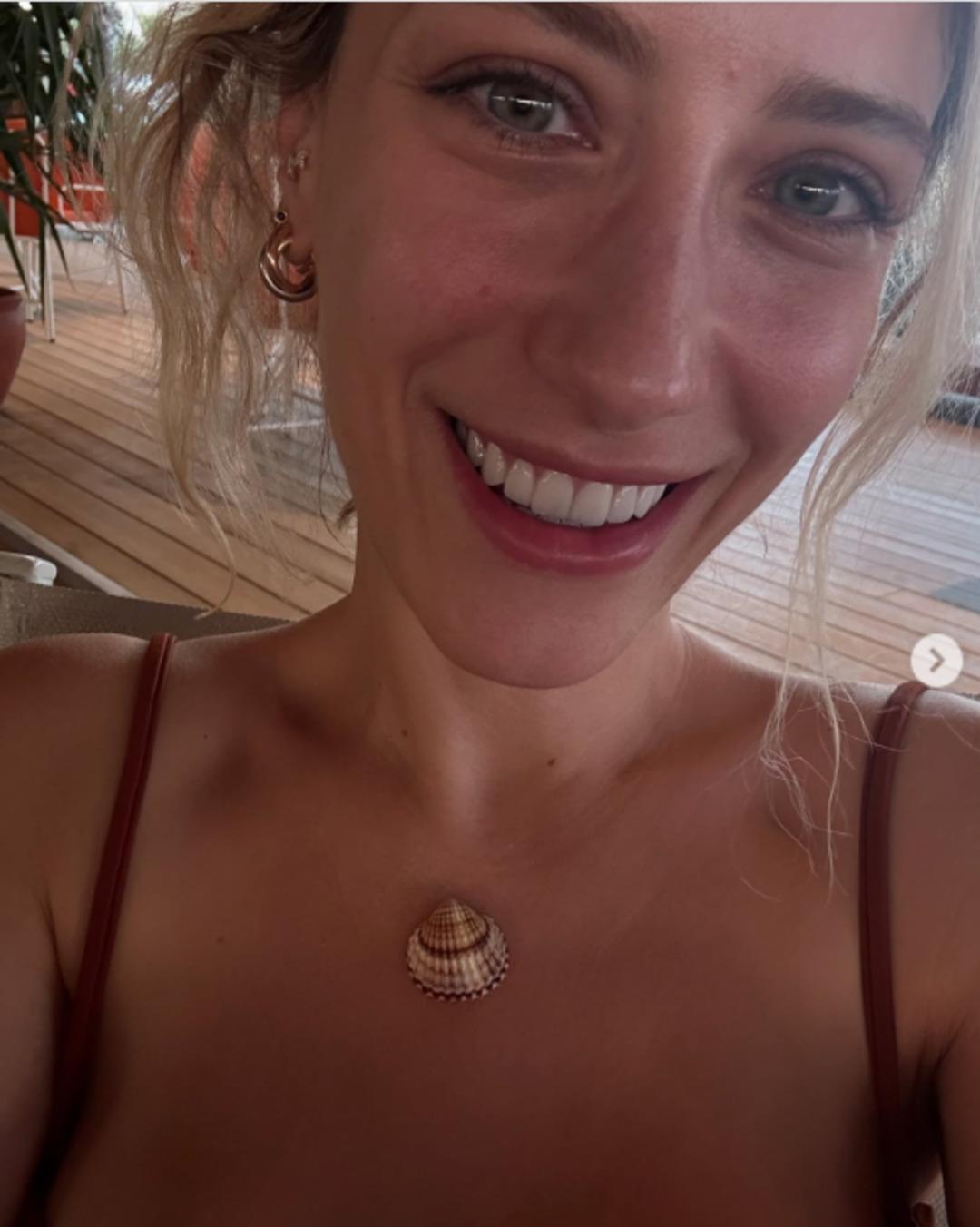 Yaptırdığı işleme tepki yağmıştı: Hazal Kaya dan estetik a&ccedil;ıklaması 2