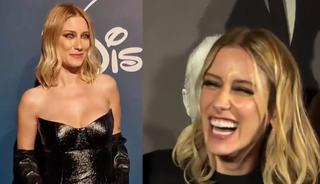 Tepki yağmıştı! Hazal Kaya'dan estetik a&ccedil;ıklaması: &ldquo;Canım &ccedil;ıktı"