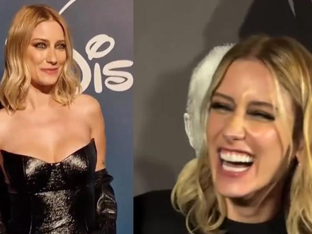 Tepki yağmıştı! Hazal Kaya'dan estetik a&ccedil;ıklaması: &ldquo;Canım &ccedil;ıktı"