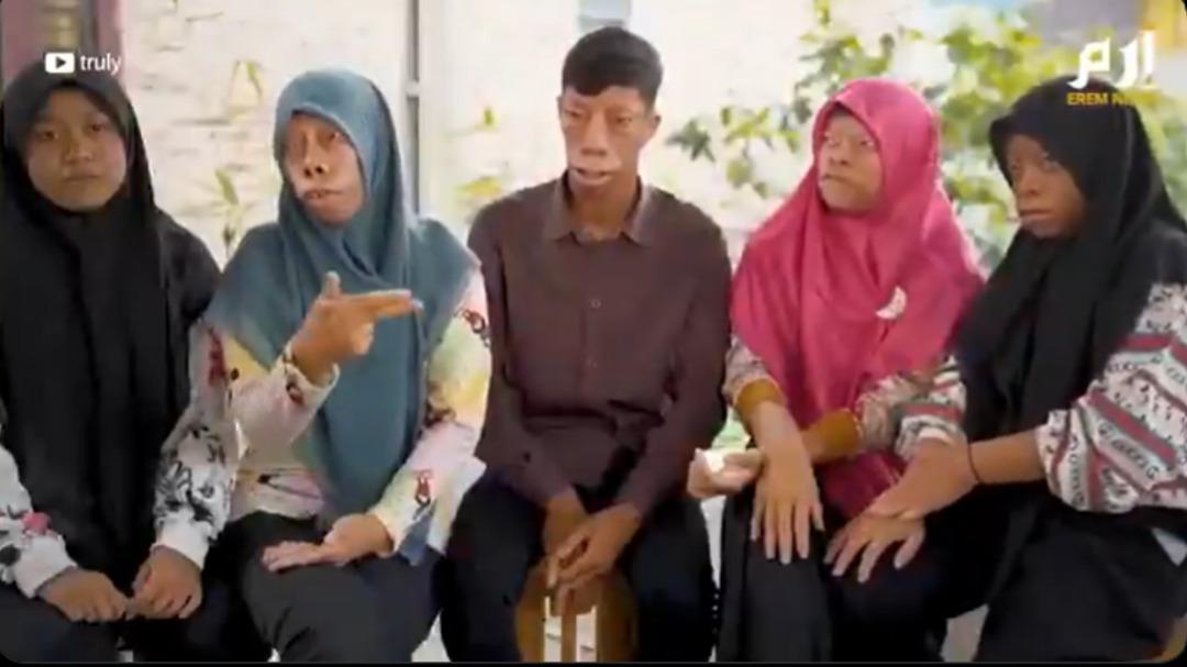 Alışılmışın &ccedil;ok dışında:  Kertenkele Ailesi ! Sosyal medyada g&uuml;ndem oldular 1