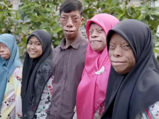 Alışılmışın &ccedil;ok dışında: 'Kertenkele Ailesi'! Sosyal medyada g&uuml;ndem oldular