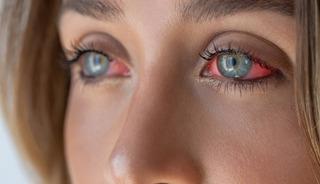 Tatile T&uuml;rkiye'ye geldi, kabusu yaşadı! G&ouml;z kapağının derinine ka&ccedil;mış: 10 g&uuml;n sonra ortaya &ccedil;ıktı