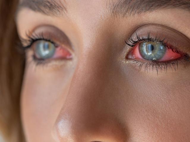 Tatile T&uuml;rkiye'ye geldi, kabusu yaşadı! G&ouml;z kapağının derinine ka&ccedil;mış: 10 g&uuml;n sonra ortaya &ccedil;ıktı