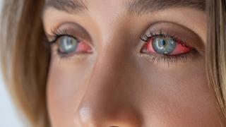 Tatile Türkiye'ye geldi, kabusu yaşadı! Göz kapağının derinine kaçmış: 10 gün sonra ortaya çıktı