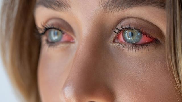 Tatile Türkiye'ye geldi, kabusu yaşadı! Göz kapağının derinine kaçmış: 10 gün sonra ortaya çıktı