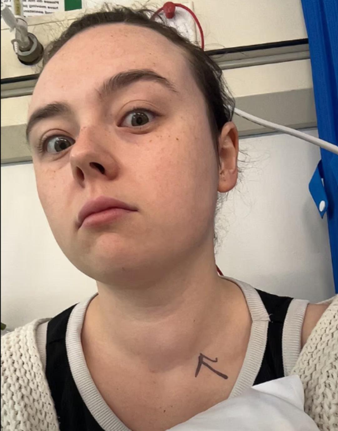 Arkadaşları fark etti: Ger&ccedil;ek aylar sonra ortaya &ccedil;ıktı! Gen&ccedil; yaşlarda g&ouml;r&uuml;lme oranı arttı 1