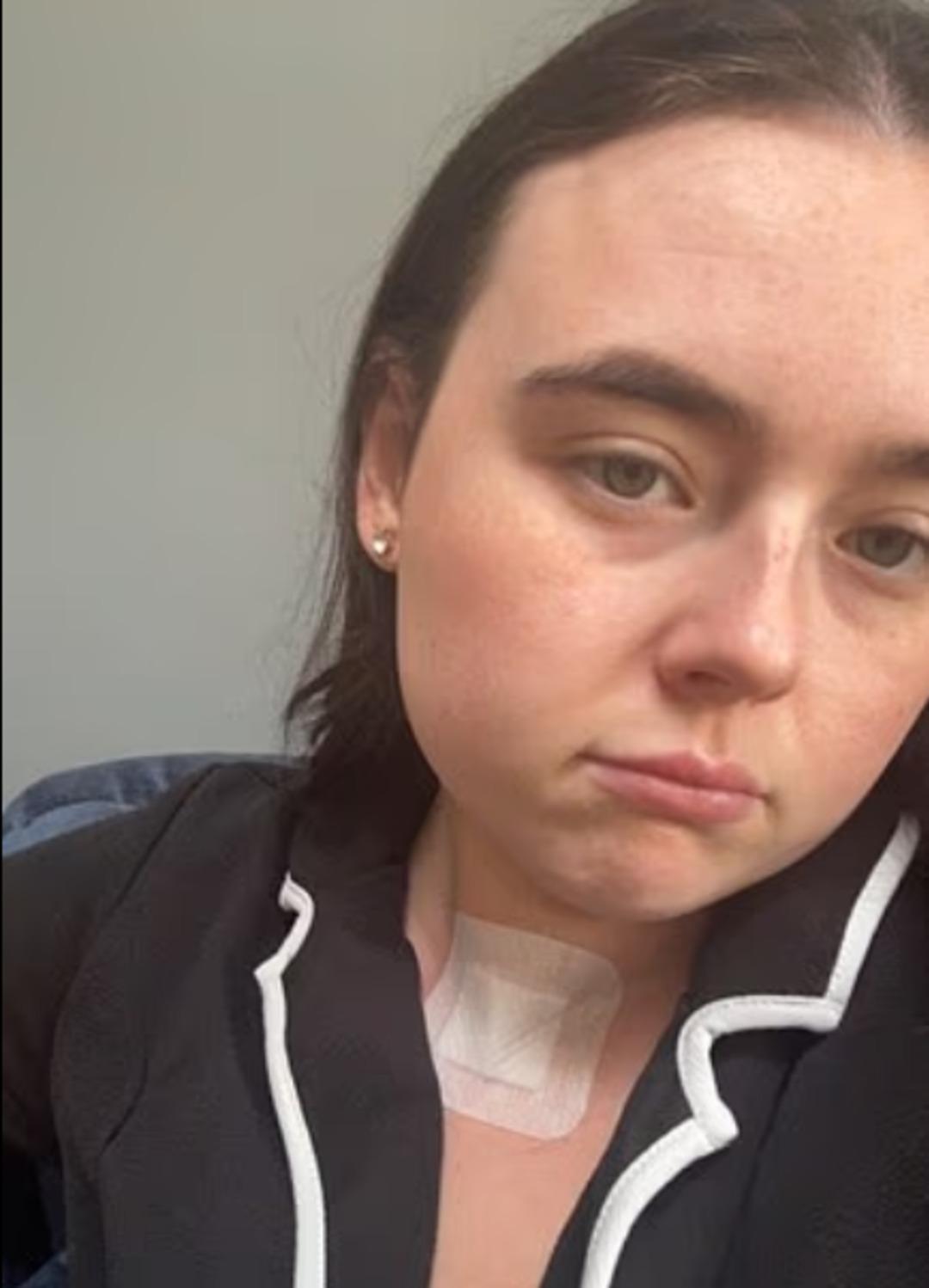 Arkadaşları fark etti: Ger&ccedil;ek aylar sonra ortaya &ccedil;ıktı! Gen&ccedil; yaşlarda g&ouml;r&uuml;lme oranı arttı 2