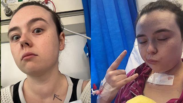 Arkadaşları fark etti: Gerçek aylar sonra ortaya çıktı! Genç yaşlarda görülme oranı arttı