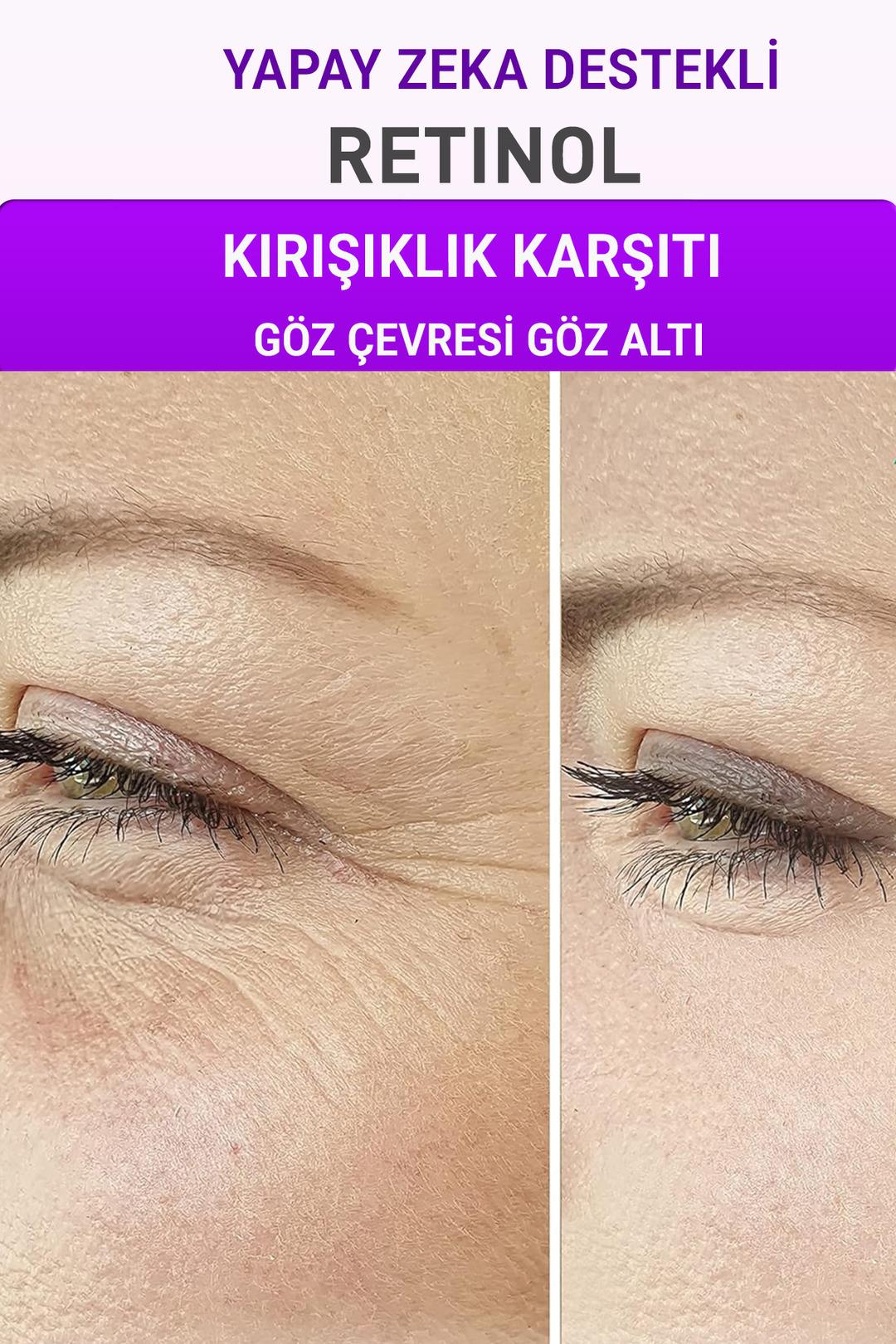 Neden bazı insanlar aynı yaşta olmasına rağmen daha genç görünüyor? 2