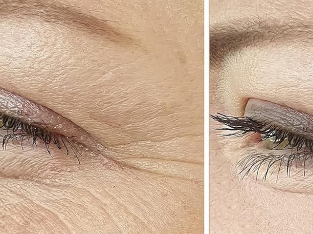 Neden bazı insanlar aynı yaşta olmasına rağmen daha gen&ccedil; g&ouml;r&uuml;n&uuml;yor?