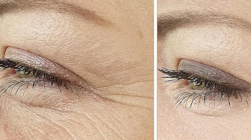 Neden bazı insanlar aynı yaşta olmasına rağmen daha gen&ccedil; g&ouml;r&uuml;n&uuml;yor?