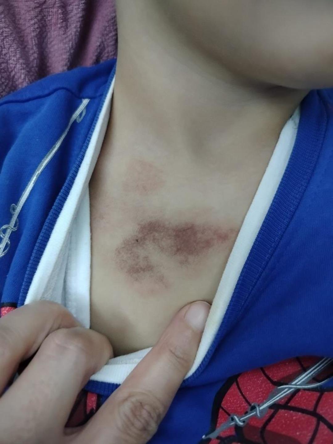 İBB kreşinde istismar ve darp iddiası: &Ccedil;ocukları tacize uğrayan aile şikayet&ccedil;i oldu 2