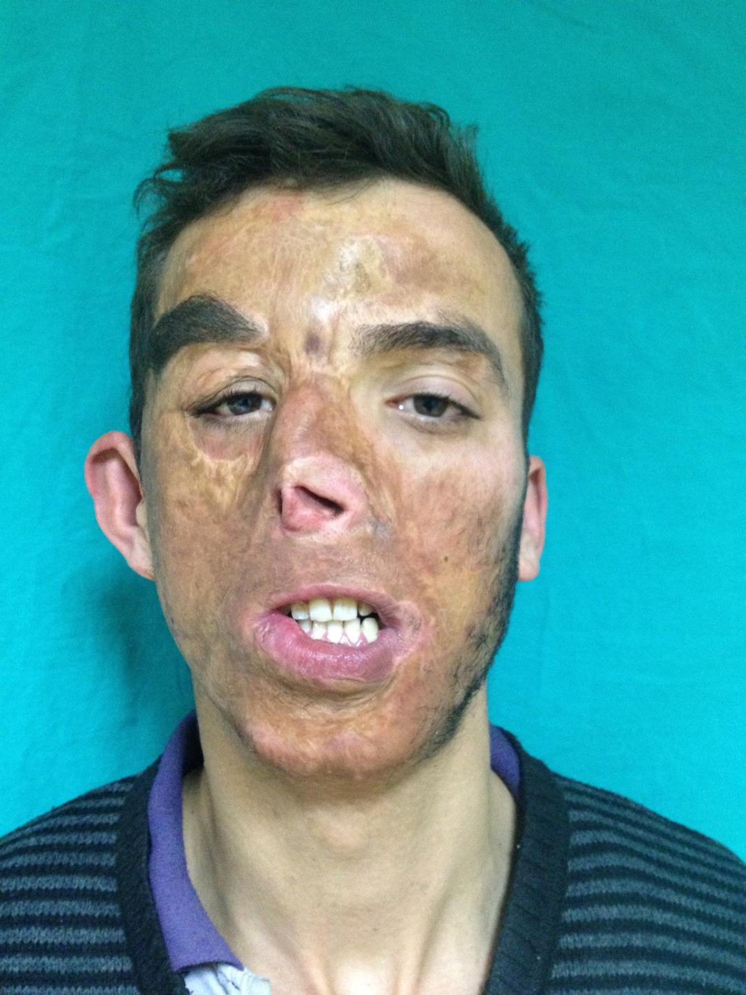 14 yıldır aynaya başka bir y&uuml;zle bakıyor! Yaşı bile o g&uuml;n değişti 3