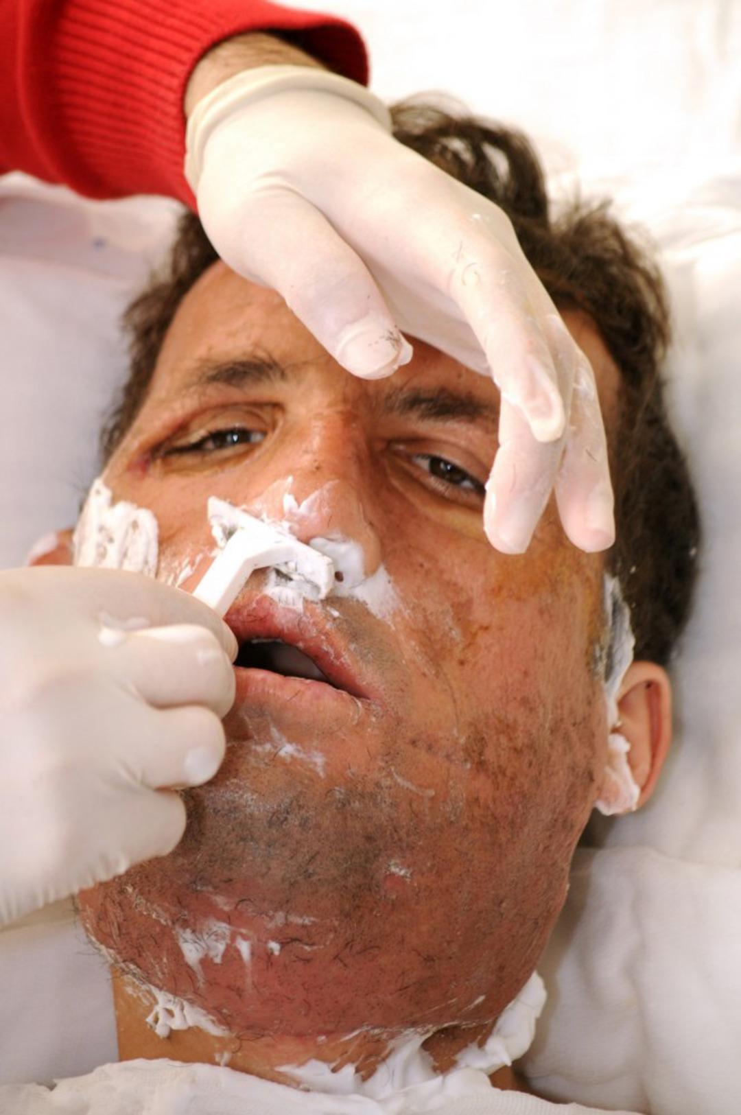 14 yıldır aynaya başka bir y&uuml;zle bakıyor! Yaşı bile o g&uuml;n değişti 6