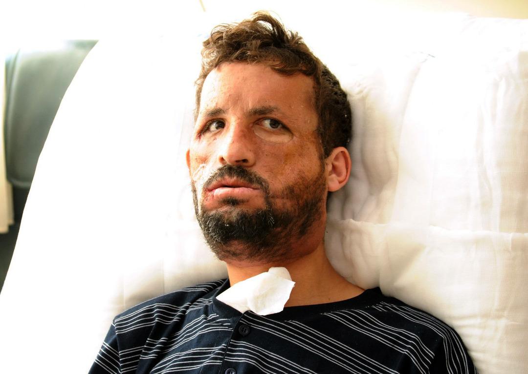 14 yıldır aynaya başka bir y&uuml;zle bakıyor! Yaşı bile o g&uuml;n değişti 5