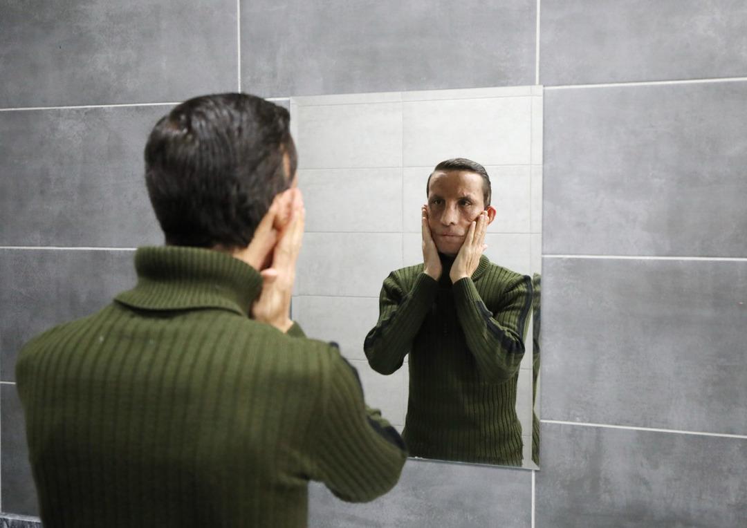 14 yıldır aynaya başka bir y&uuml;zle bakıyor! Yaşı bile o g&uuml;n değişti 7