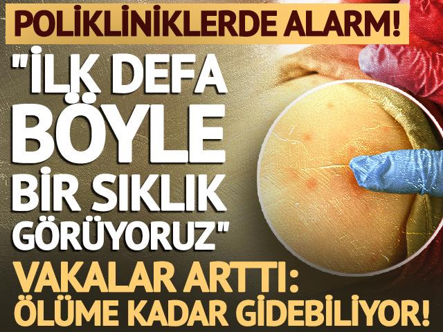 Uzman isim "İlk defa b&ouml;yle bir sıklık g&ouml;r&uuml;yoruz" diyerek uyardı!