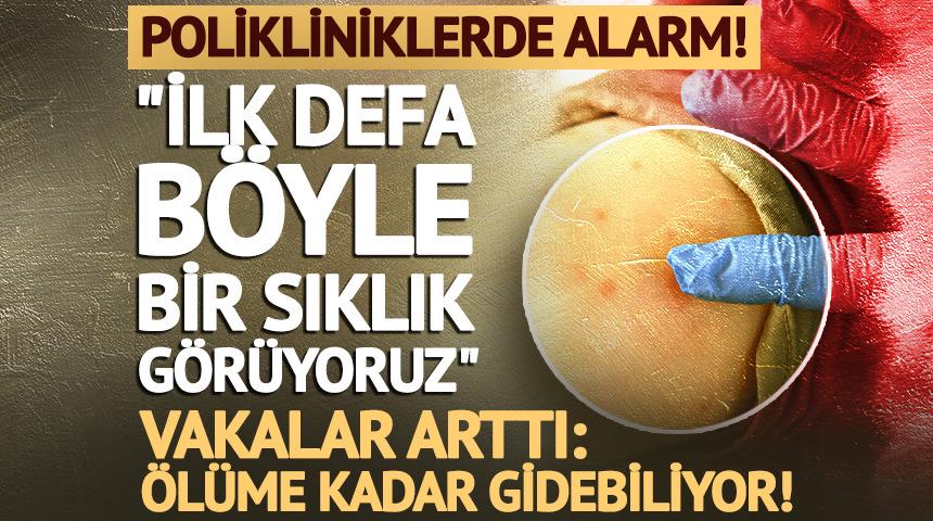 Uzman isim "İlk defa b&ouml;yle bir sıklık g&ouml;r&uuml;yoruz" diyerek uyardı!