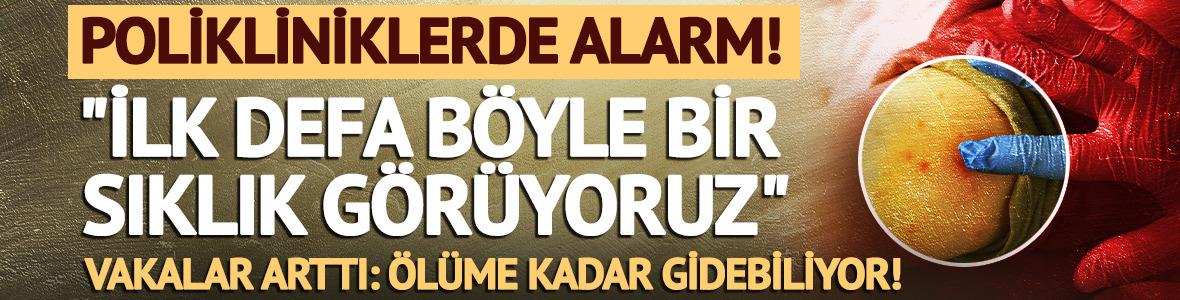 Uzman isim "İlk defa b&ouml;yle bir sıklık g&ouml;r&uuml;yoruz" diyerek uyardı!