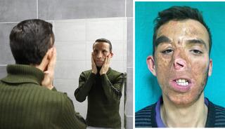 14 yıldır aynaya başka bir y&uuml;zle bakıyor! Yaşı bile değişti