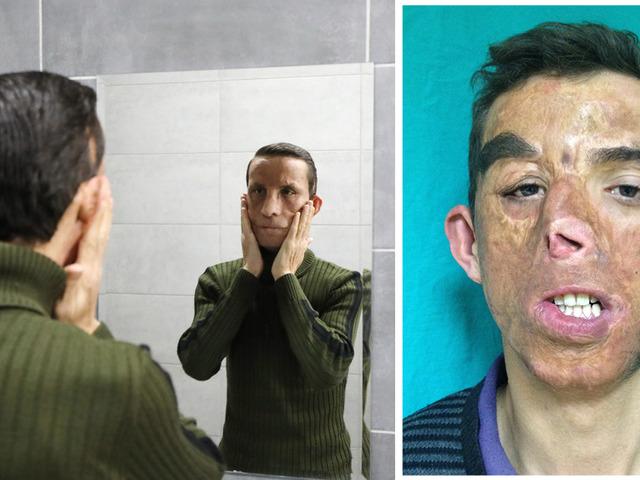 14 yıldır aynaya başka bir y&uuml;zle bakıyor! Yaşı bile o g&uuml;n değişti