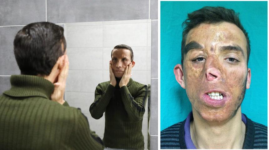 14 yıldır aynaya başka bir y&uuml;zle bakıyor! Yaşı bile değişti