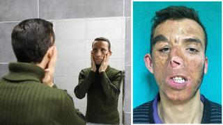 14 yıldır aynaya başka bir yüzle bakıyor! Yaşı bile o gün değişti