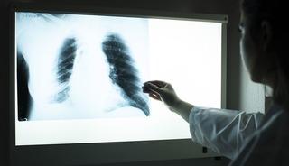 Ge&ccedil;mişte kalmadı: Uzmanlardan "hala aramızda" uyarısı