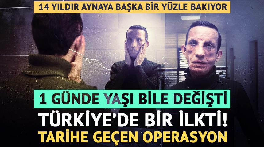 14 yıldır aynaya başka bir y&uuml;zle bakıyor! Yaşı bile değişti