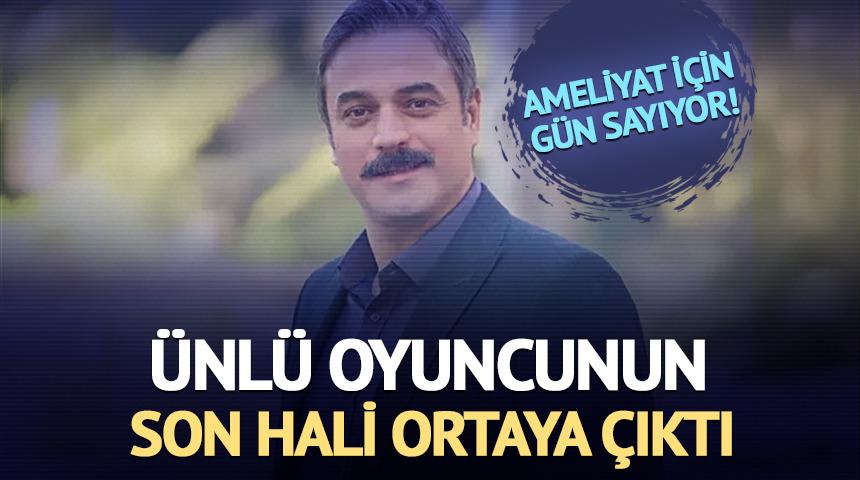 Ameliyat i&ccedil;in g&uuml;n sayıyor! Son hali ortaya &ccedil;ıktı