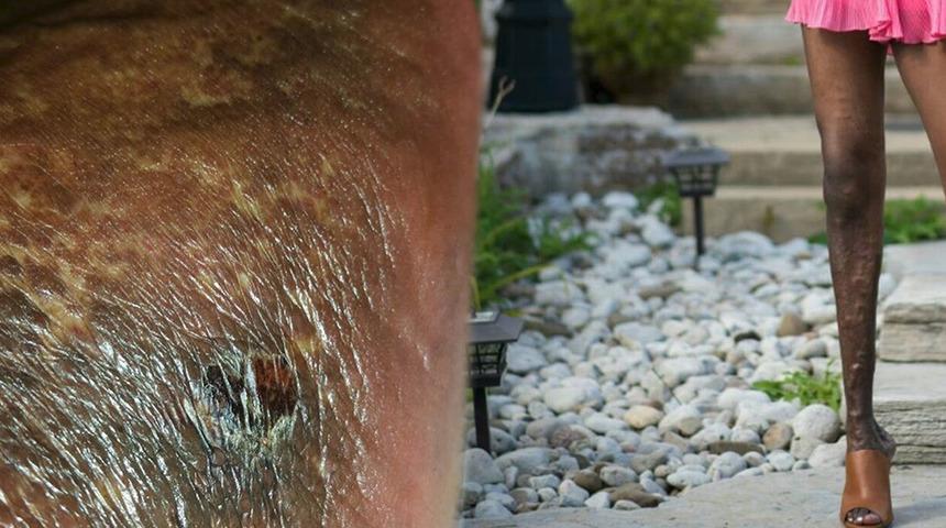 Yıllardır '&ccedil;irkin bacak' diye alay edildi