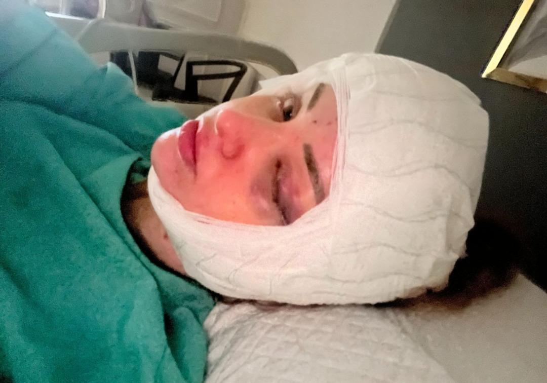 Ucuz olsun isterken suratından oluyordu: Yaptırdığı estetik işlem hayatını mahvetti 1