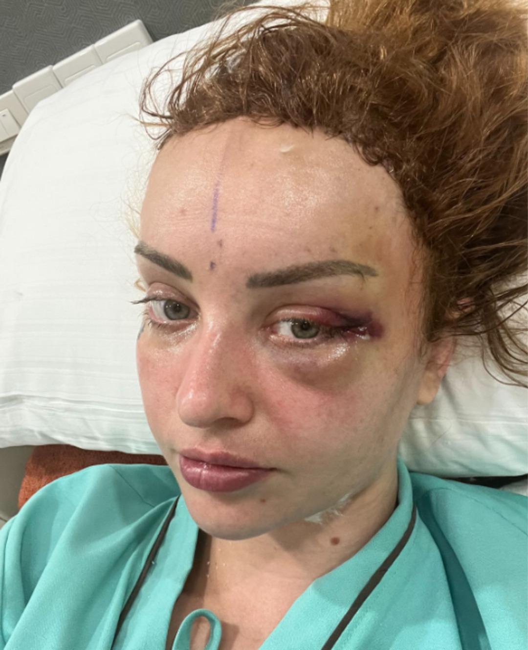 Ucuz olsun isterken suratından oluyordu: Yaptırdığı estetik işlem hayatını mahvetti 2