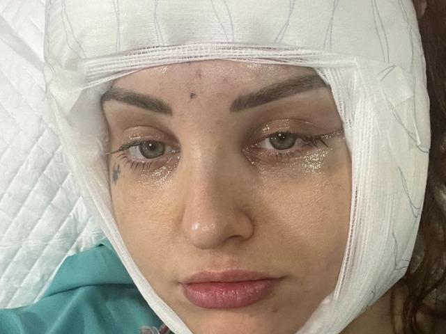 Yaptıracağı estetik ucuz olsun isterken suratından oluyordu