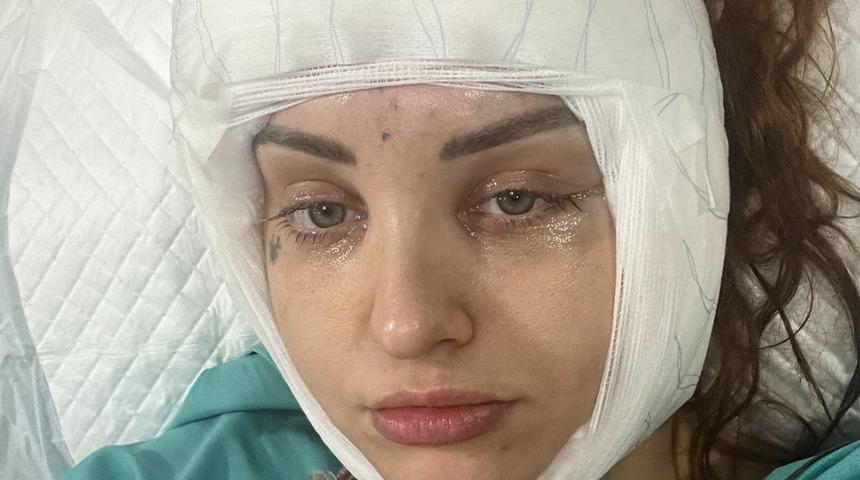 Ucuz olsun isterken suratından oluyordu: Yaptırdığı estetik işlem hayatını mahvetti