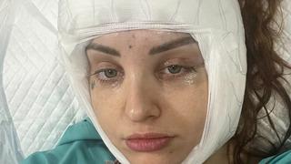 Ucuz olsun isterken suratından oluyordu: Yaptırdığı estetik işlem hayatını mahvetti