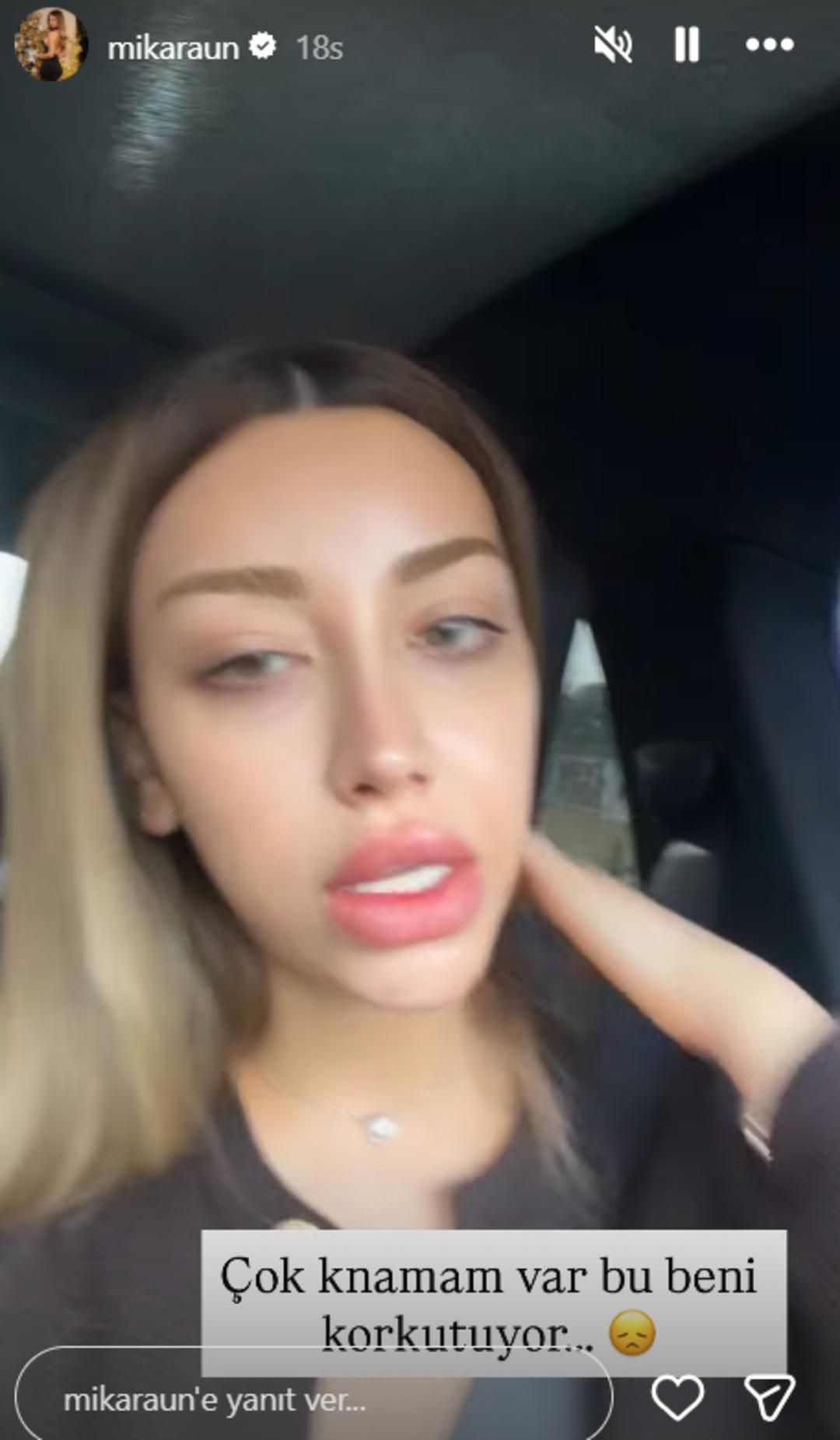 Cinsiyet değiştirmişti! Mika Raun  kanamam var  deyip jinekoloğa koştu 2