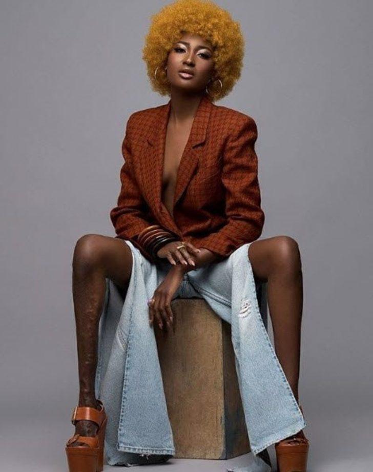 Küçükken herkes dalga geçiyordu, şimdi podyumların aranan yüzü oldu G2