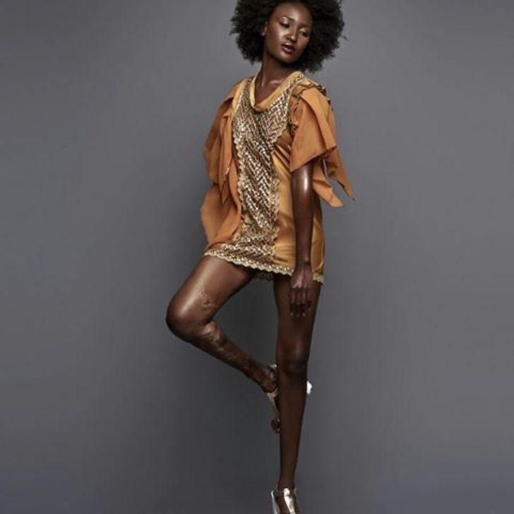 Küçükken herkes dalga geçiyordu, şimdi podyumların aranan yüzü oldu G5