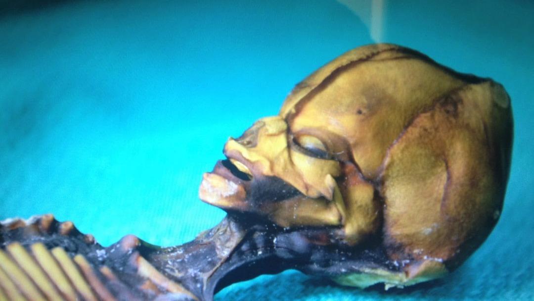 Herkes uzaylı olduğuna inanmıştı! Altından trajedi &ccedil;ıktı