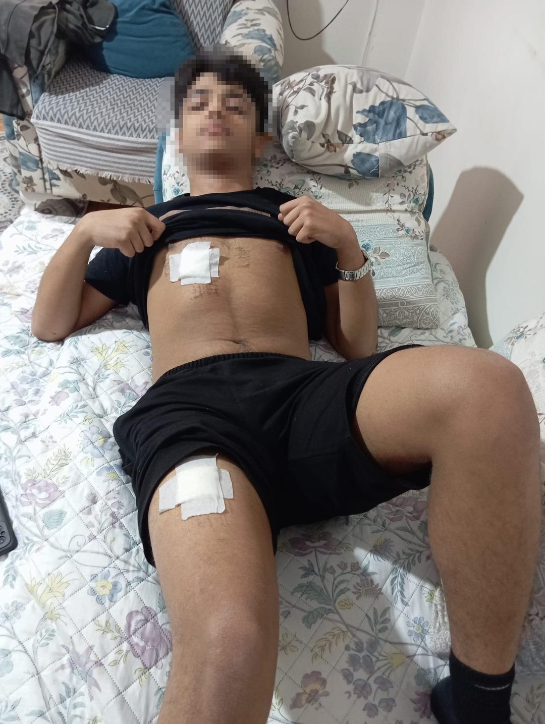 Yine &ccedil;ocuk su&ccedil;lu! Kavga sebebi kız meselesi: G&ouml;ğs&uuml;nden ve bacaklarından bı&ccedil;akladı 2