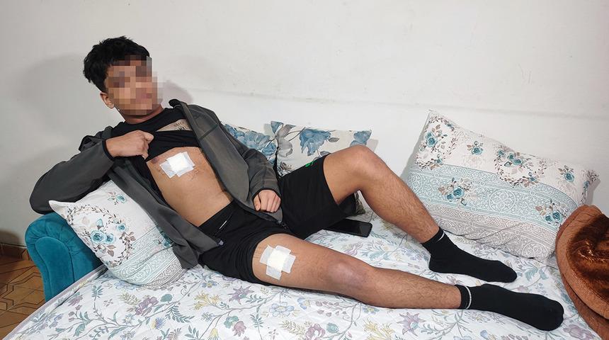 Yine &ccedil;ocuk su&ccedil;lu! Kavga sebebi kız meselesi: G&ouml;ğs&uuml;nden ve bacaklarından bı&ccedil;akladı