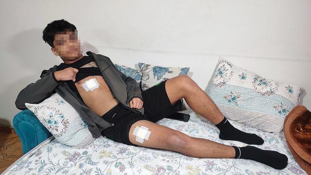 Yine çocuk suçlu! Kavga sebebi kız meselesi: Göğsünden ve bacaklarından bıçakladı