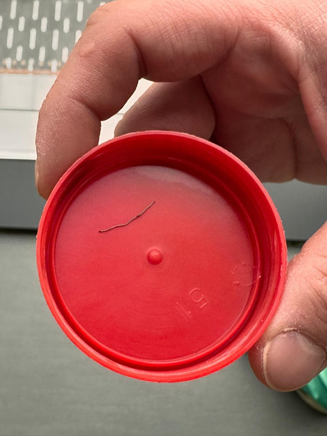 1 yaşındaki bebeğin sırtından 2 santimlik metal tel &ccedil;ıktı!  2